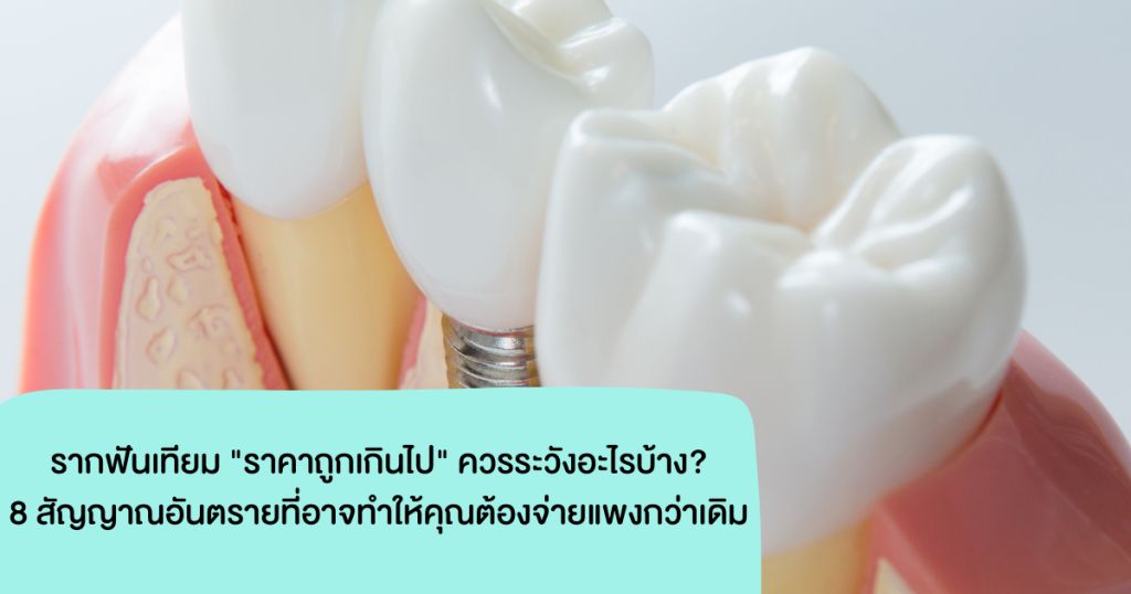 การทำรากฟันเทียม “ราคาถูกเกินไป” ควรระวังอะไรบ้าง? 8 สัญญาณอันตรายที่อาจทำให้คุณต้องจ่ายแพงกว่าเดิม